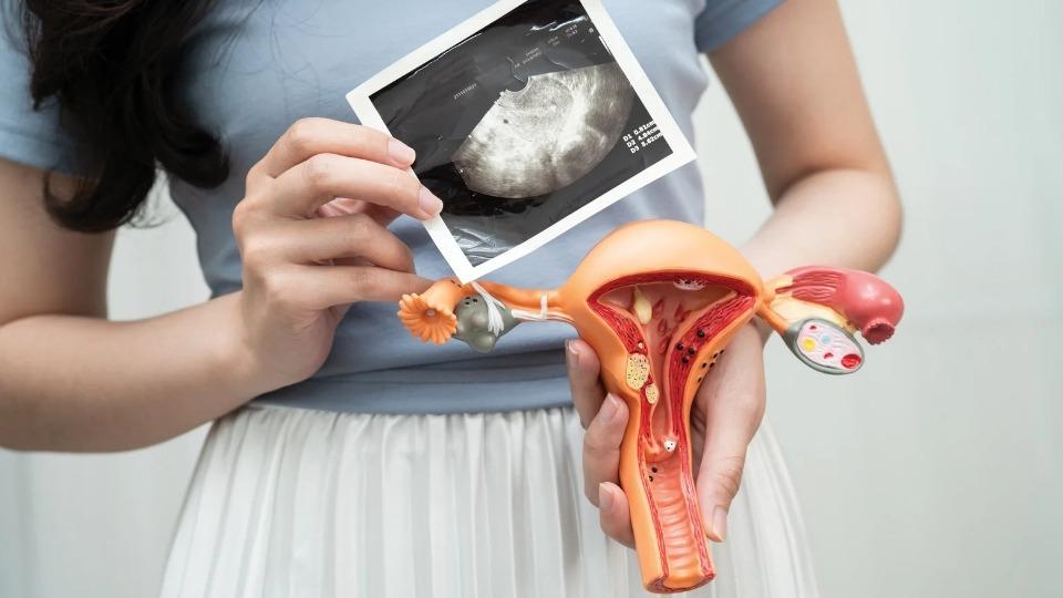 Rahim Copot Kerap Dikaitkan Dengan Prolaps Uteri Cek Faktanya Yuk!