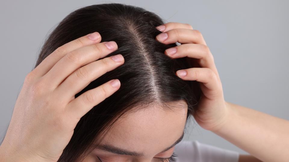Scalp Care: Rahasia Rambut Sehat yang Sering Terlewat!